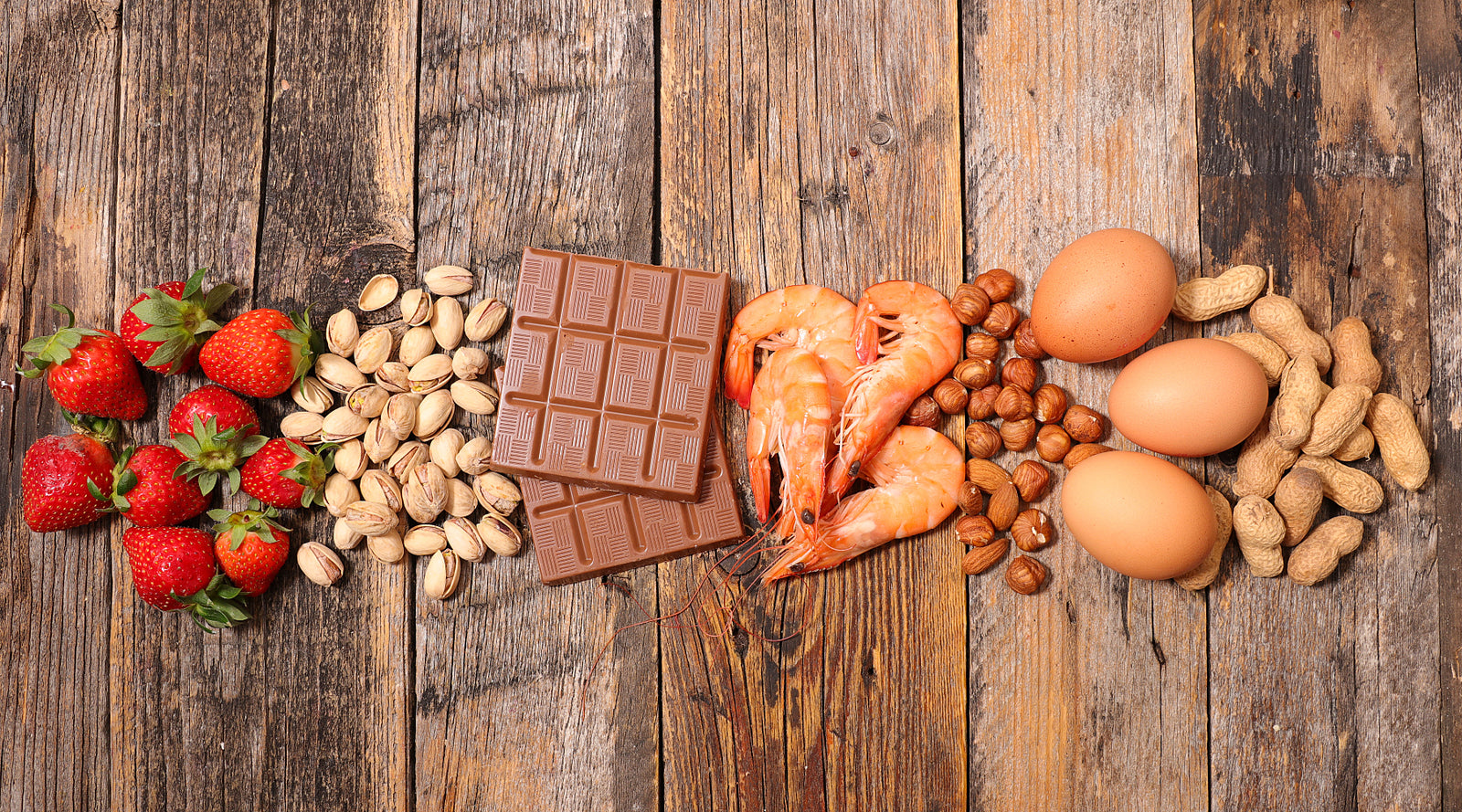 Common food allergies