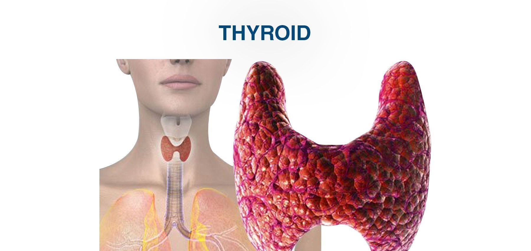 Thyroid