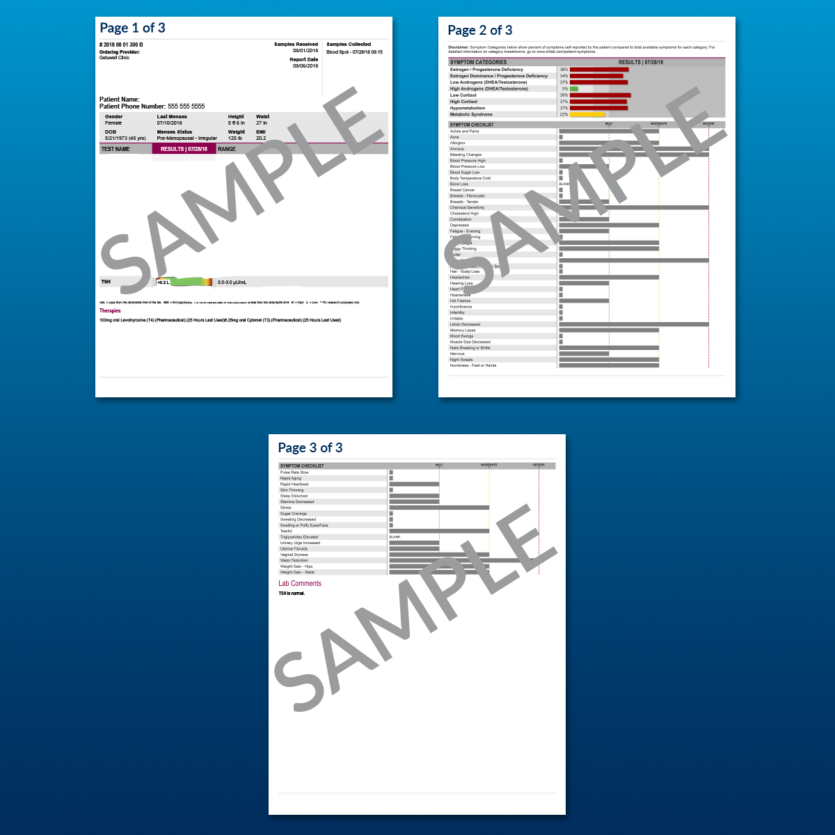 Thyroid TSH Test (Consult Not Included)